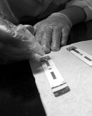 &iquest;Qu&eacute; diferencia hay entre ser sero-positivo y tener el sida?